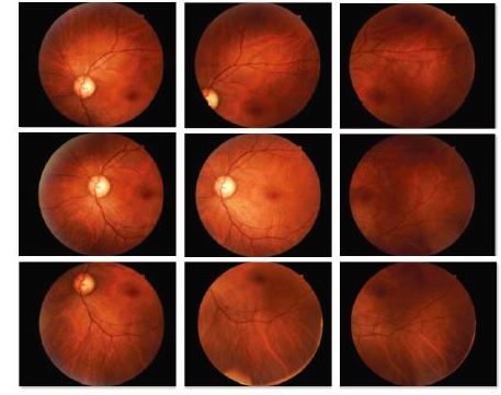 Retinografia Studio Oculistico Taranto