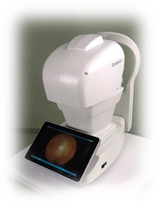 fundus camera - Retinografia